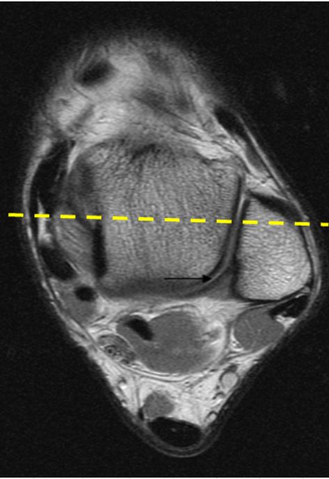 MR Ankle & Hindfoot – RIA Protocols