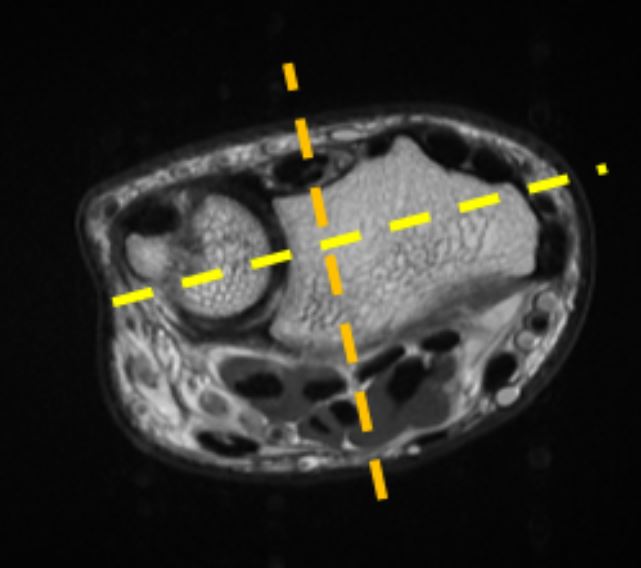 MR Wrist – RIA Protocols